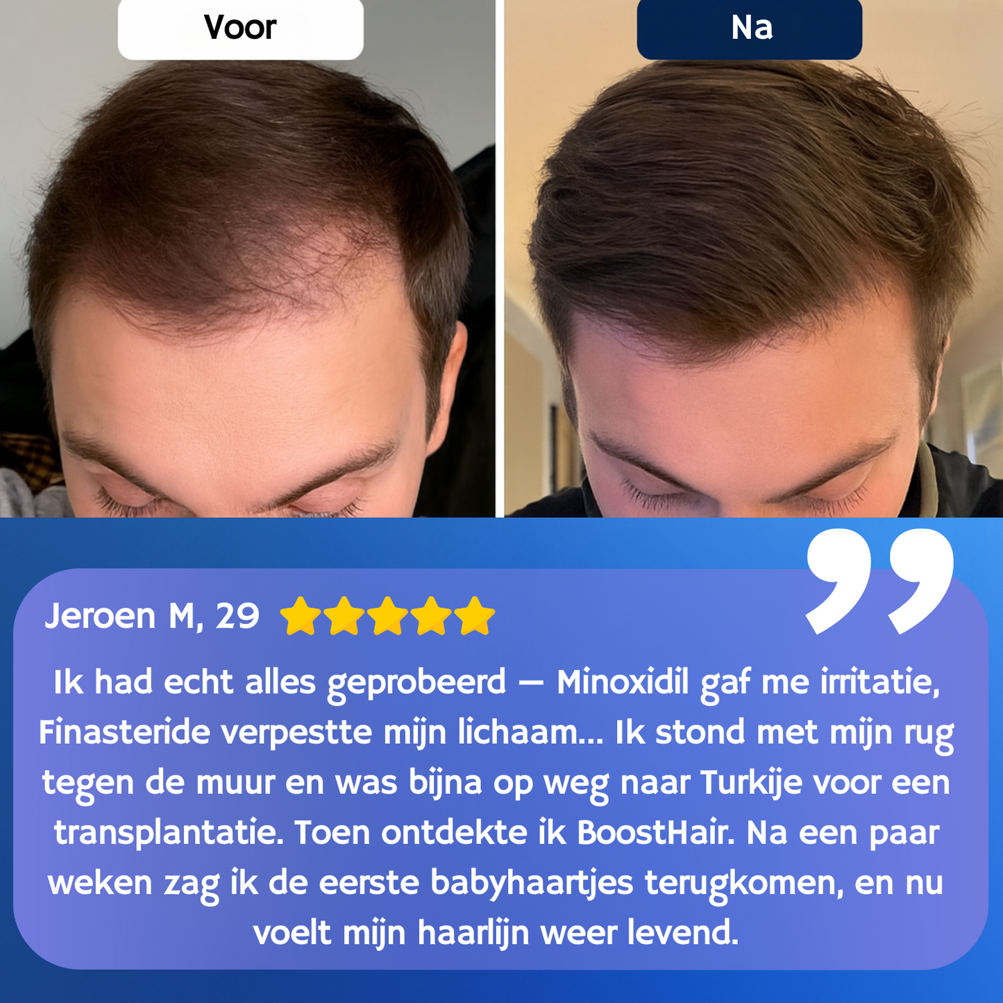 BoostHair™ Serum